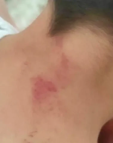 Şanlıurfa’da öğrencisini döven öğretmen tutuklandı