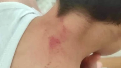 Şanlıurfa’da öğrencisini döven öğretmen tutuklandı